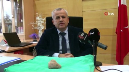 Mesaneden Tek Parça Halinde 10 Santim ve 270 Gram Taş Çıkardılar