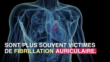 Les migraines avec aura augmenteraient le risque d'AVC