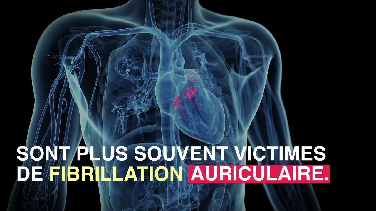 Les migraines avec aura augmenteraient le risque d'AVC
