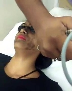 Skin Pigmentation Removal at Delhi Laser Clinic