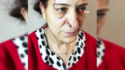 Platonik Aşk Dehşeti.. Yaraladığı Kadına 80 Dikiş Atıldı