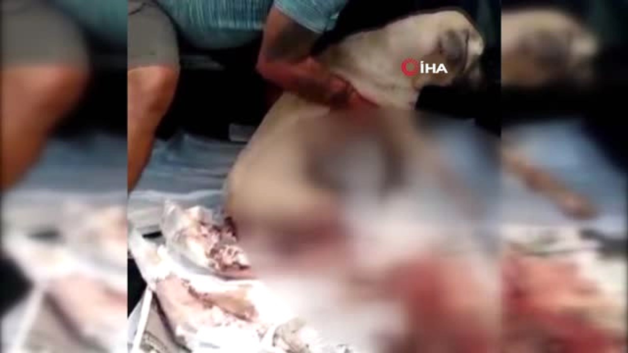 Tren Bacaklarını Parçaladı, Pes Etmeyip Hayata Tutundu