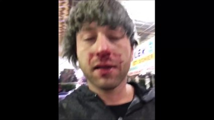 Medyada ilk haber / Survivor Taner… 20 KİŞİNİN SALDIRISINA UĞRADI!