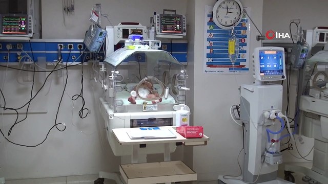 Kalbi göbeğinde olan bebek herkesi şaşırttı