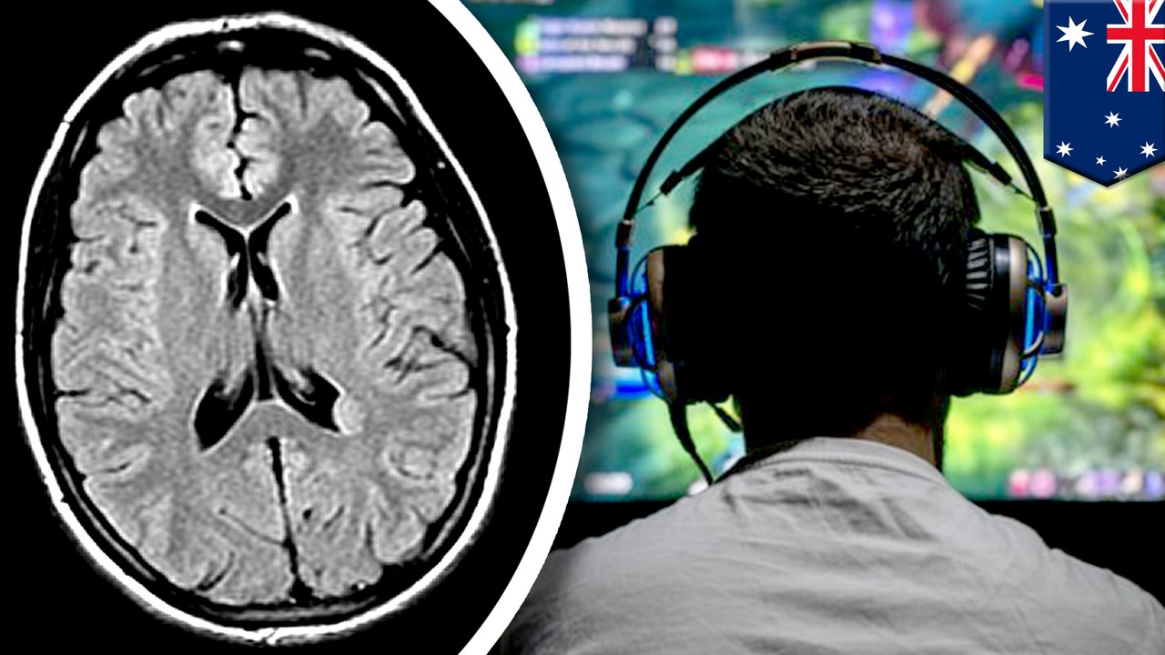 Study shows gaming may increase brain's gray matter