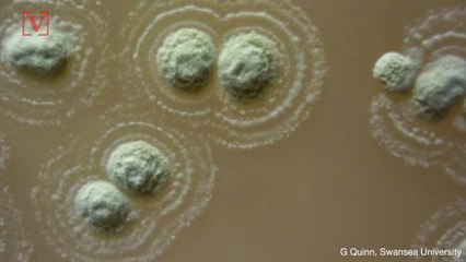 Bacteria Discovered in Ancient Soil Could Help Stop Superbugs