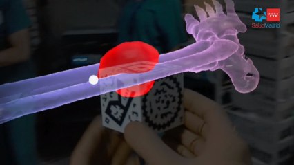 Así funciona el nuevo sistema de cirugía del Gregorio Marañón.