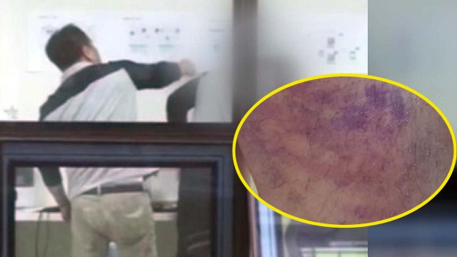'잊혀질 권리' 송명빈, '직원 폭행' 피소...피해 영상 공개 / YTN