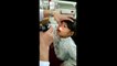Un médecin retire une étrange bestiole vivante du nez de cette fillette