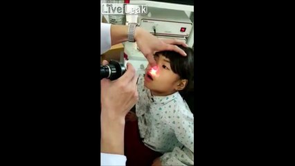 Un médecin retire une étrange bestiole vivante du nez de cette fillette
