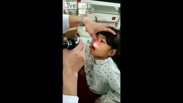 Un médecin retire une étrange bestiole vivante du nez de cette fillette