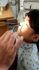 Un médecin retire une une étrange bestiole vivante du nez d'une fillette !