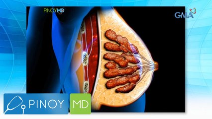 Pinoy MD: Hirap ng pagkakaroon ng malaking hinaharap