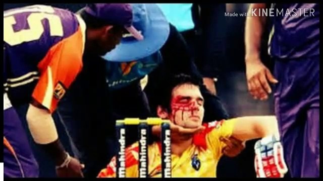 TOP 10 BRUTAL INJURIES IN CRICKET HISTORY | 2018