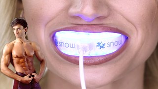 BEST TEETH WHITENING KIT | Fit Now with Basedow #162