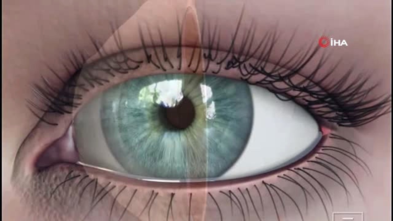 5 Dakikada Gözünüzdeki Perdeyi Kaldırın