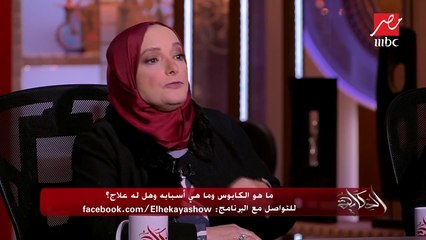#الحكاية | الإنسان المفروض يجيله كام كابوس أو حلم في اليوم؟