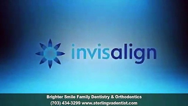 Clear Braces Sterling VA