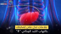 فيديو معلوماتي.. علامات تدل على إصابتك بالتهاب الكبد الوبائي  