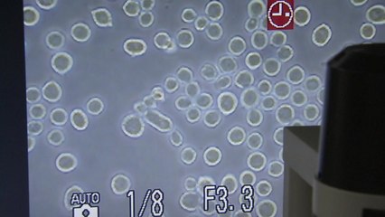 국내 개에서 노로바이러스 감염 첫 확인...사람과 교차 감염 '주의' / YTN