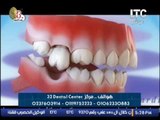 بالفيديو ... اخصائى جراحات الأسنان يحذر من خطورة فقدان الاسنان و عدم تعويضها