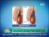 استاذ في الطب | مع شيرين سيف النصر و د. أسامه الحصرى 