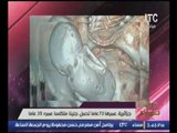 بالصور  .. د.هاني الناظر يكشف أسباب حمل سيدة عمرها73عام في طفل لمدة 35 عام