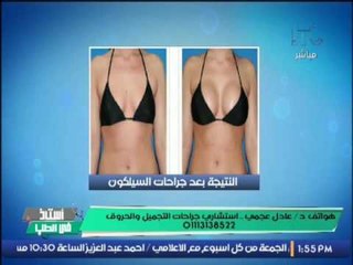 د /عادل عجمى يجيب على " هل يوجد مضاعفات لعملية تكبير الثدى ؟ "