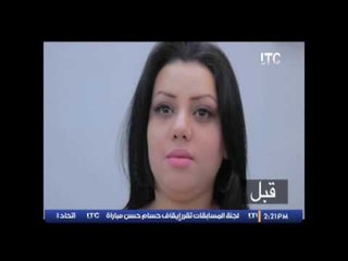 برنامج استاذ فى الطب |  مع د / ولاء ابو الحجاج حول التجميل والجمال - 22-11-2016