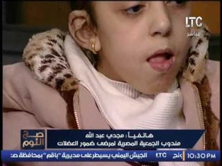 مندوب الجمعية المصرية لمرضى ضمور العضلات يصرخ على الهواء إحنا لو كلاب كانت الدولة هتعالجنا