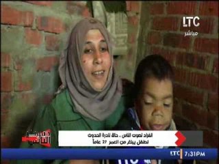 بالفيديو .. والدة الطفل البالغ 27 عاما تأكله بفمها على طريقة الطيور .. مؤثرة جدا