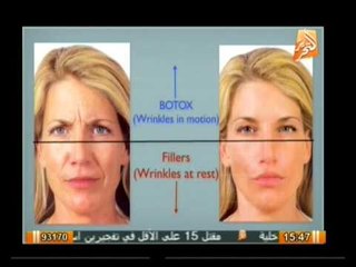 عيادة التحرير: التغيرات فى ملامح الوجه والجسم مع تقدم العمر