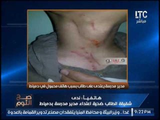 حصرى .. اول مداخلة مع شقيقة الطالب ضحية اعتداء مدير مدرسه بدمياط و صدمة الغيطى