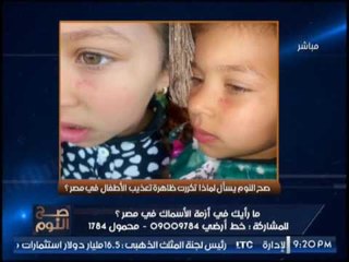 بالصور.. " صح النوم " يرصد كارثة تعذيب طفله من والدها و تعليق نارى لــ الغيطى
