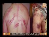 بالصور تعذيب وحشي من حماس لمناضل فلسطيني لإرضا اسرائيل - للكبار فقط ( 18 )