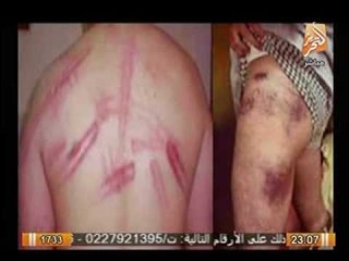 بالصور تعذيب وحشي من حماس لمناضل فلسطيني لإرضا اسرائيل - للكبار فقط (+18 )