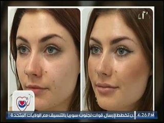برنامج صحتك في امان مع د. ايمان | مع أ.د ايمان سند حول استخدامات البوتكس والفيلر بالتجميل 21-4-2017