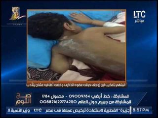 بالصور .. " صح النوم"  يكشف تفاصيل تعذيب طفل بحرق عضوه الذكرى و خلع أظافرة .. مؤثر جدا