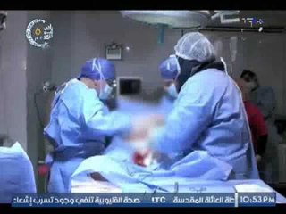 برنامج مع أ.د.محمد مقبل | شرح كامل لــ " عملية قيصرية لولادة ولدين "  - 20-5-2017