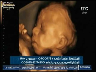 حدث سعيد | أ.د عادل فاروق البيجاوي ورحلة الحمل الاسبوع 26 | 4-8-2017