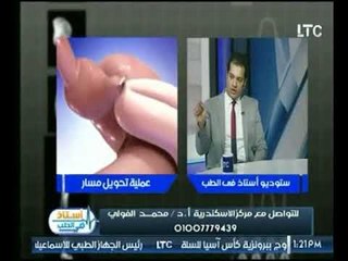برنامج استاذ في الطب | مع شيرين سيف النصر ود.محمد الفولي حول تحويل مسار المعدة-21-8-2017
