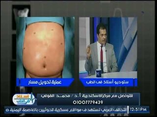 برنامج أستاذ في الطب | د. محمد الفولي حول علاج السمنة بعمليات تحويل المسار 13-8-2017