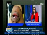 برنامج استاذ في الطب | مع سلوى عبد الغفار ود.مينا ماهر حول زراعة الاسنان-18-9-2017