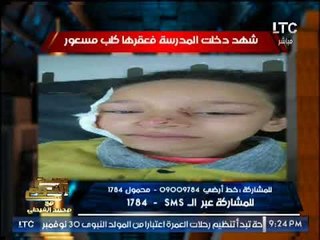 بالصور .. "صح النوم" يرصد إنتشار الكلاب المسعوره بمدارس مصر يهدد الطلبه