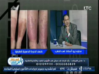 استاذ في الطب |مع  د. عادل الفرجاني حول استخدام الاوزون لعلاج الجلطات القلبيه 26-11-2017