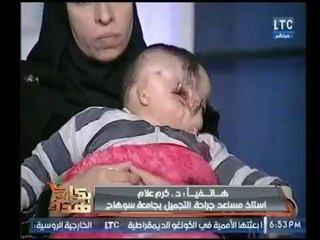 "طبيب تجميل"   يعد عالهواء بعلاج أغرب طفل " بـ " عين واحدة " ورد فعل الأم