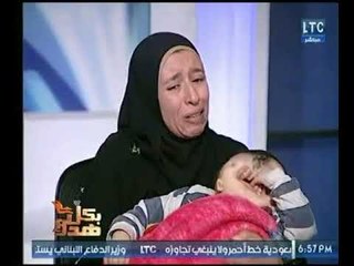 والدة أغرب طفل يولد بعين واحد تُبكي عماد صديق :"الناس بتعايرني"