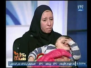 والدة اغرب طفل يولد بعين واحده تستغيث بـ " السيسي " عالهواء لعلاجه
