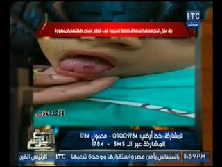 بالصور : ربة منزل تحرر محضرر ضد حضانه تسببت بقطع لسان طفلتها