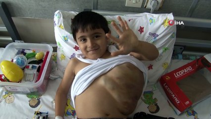 Minik Yasin vücudunu kaplayan dev kitle ile mücadele ediyor